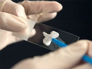 ‘Kanser tarama testleri yaygınlaştırılmalı’