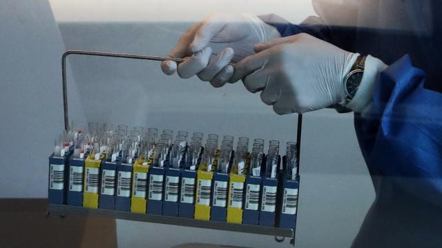 Güney Kıbrıs’ta haftalık koronavirüs rakamları açıklandı