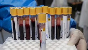 Türk bilim adamından kanser teşhisinde çığır açacak çalışma