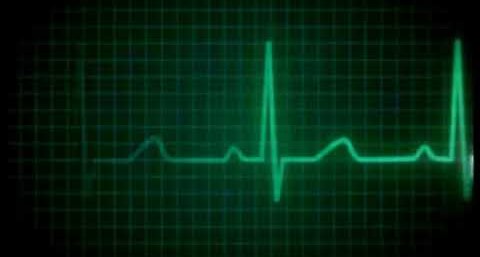 Polis haberleri…Girne’de ani ölüm – BRTK