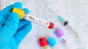 Belediyelerin pazar yerlerinde prostat kanseriyle ilgili ücretsiz tarama testi yapılacak – BRTK