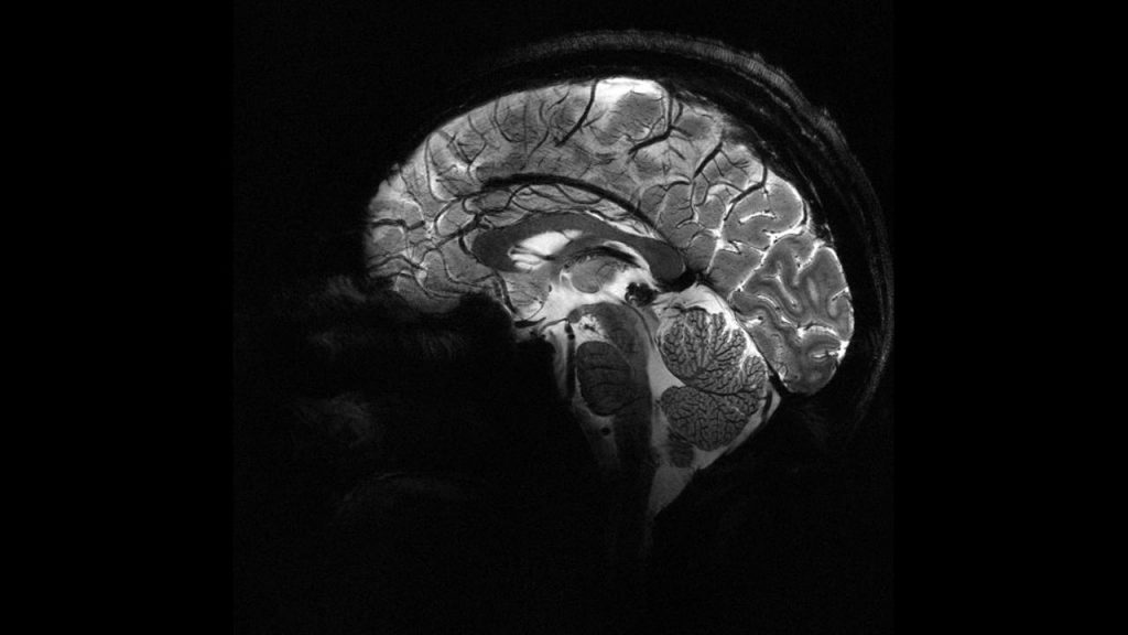 İnsan beyninin en güçlü MRI cihazıyla çekilen en net görüntüsü yayınlandı – BRTK