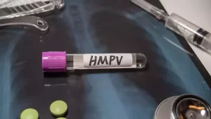 Güney Kıbrıs’ta 4 HMPV vakası saptandı