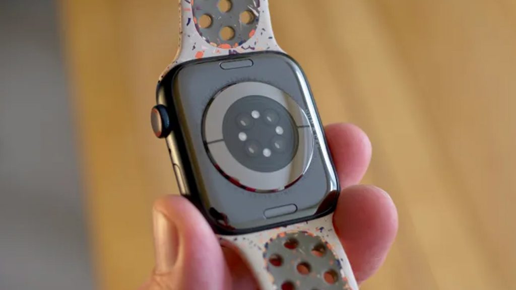 Apple Watch’un pili şişti! Apple kişi başı 50 dolar ödeyecek