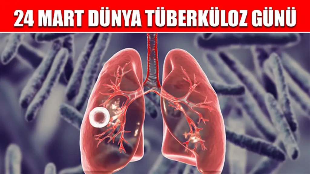 Sağlık Bakanlığı’ndan Dünya Tüberküloz Günü açıklaması