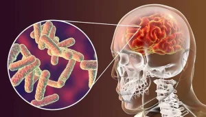 Güney’de 17 yaşındaki genç menenjitten hayatını kaybetti