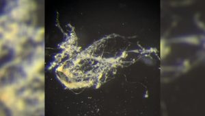 Bilim İnsanları elektrik ileten yeni bakteri türü keşfetti