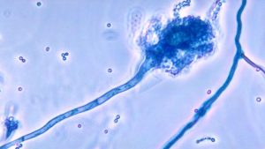 Ölümcül mantar hastalığı, küresel ısınmayla yayılabilir